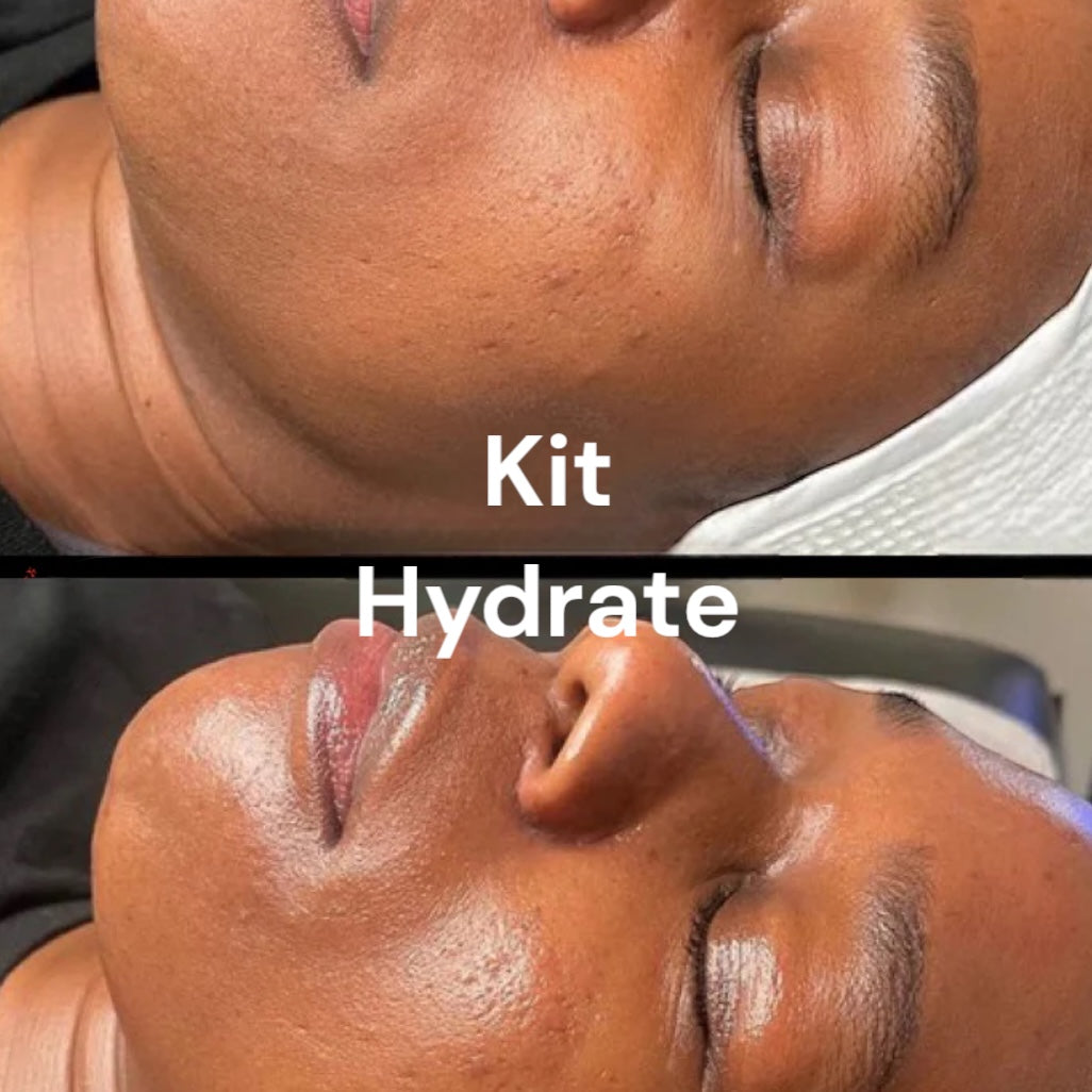 Stylo à Bulle d’Oxygène - Soin visage